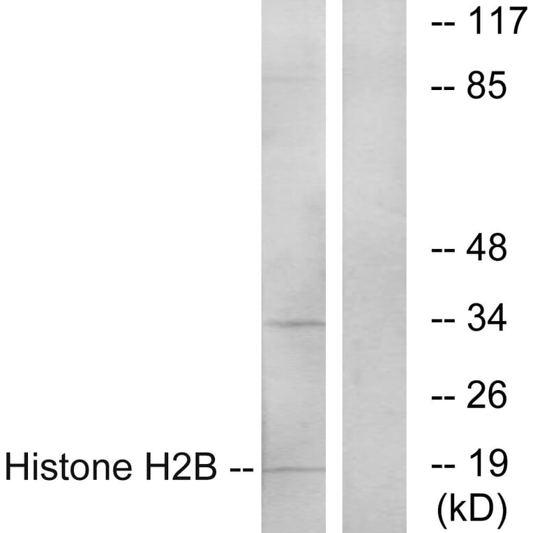 Western Blot - Anti-Histone H2B Antibody (C11456) - Antibodies.com