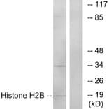 Western Blot - Anti-Histone H2B Antibody (C11456) - Antibodies.com