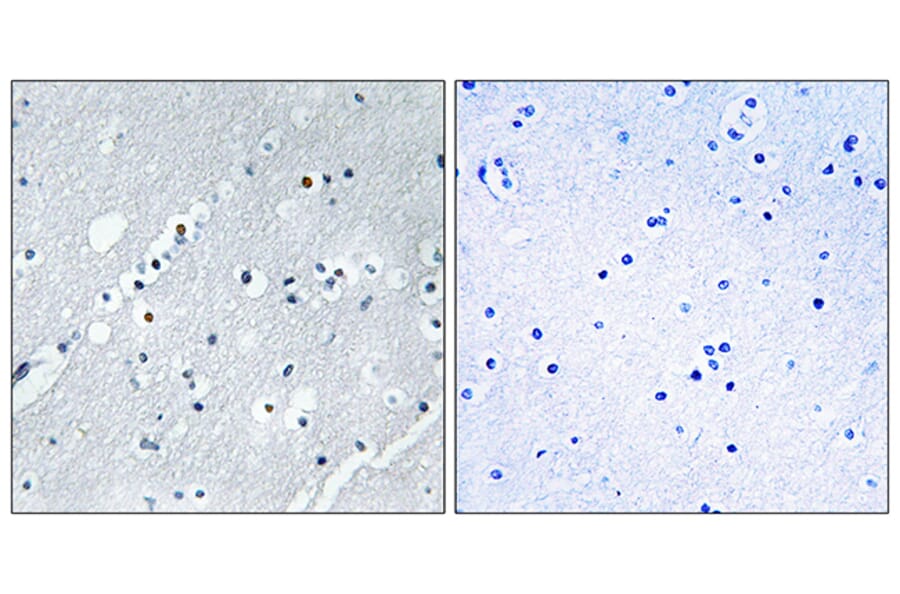 Immunohistochemistry - Anti-Histone H2B Antibody (C11456) - Antibodies.com
