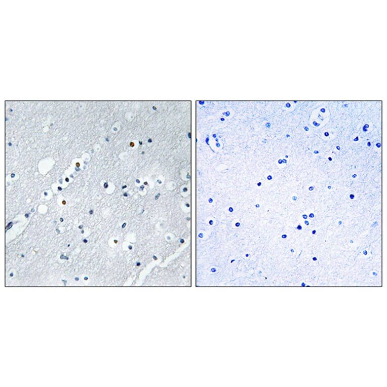 Immunohistochemistry - Anti-Histone H2B Antibody (C11456) - Antibodies.com