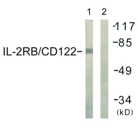 Western Blot - Anti-IL-2R beta Antibody (B1063) - Antibodies.com