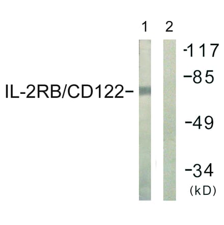 Western Blot - Anti-IL-2R beta Antibody (B1063) - Antibodies.com