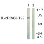 Western Blot - Anti-IL-2R beta Antibody (B1063) - Antibodies.com