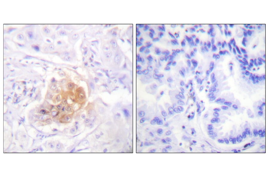 Immunohistochemistry - Anti-IL-2R beta Antibody (B1063) - Antibodies.com