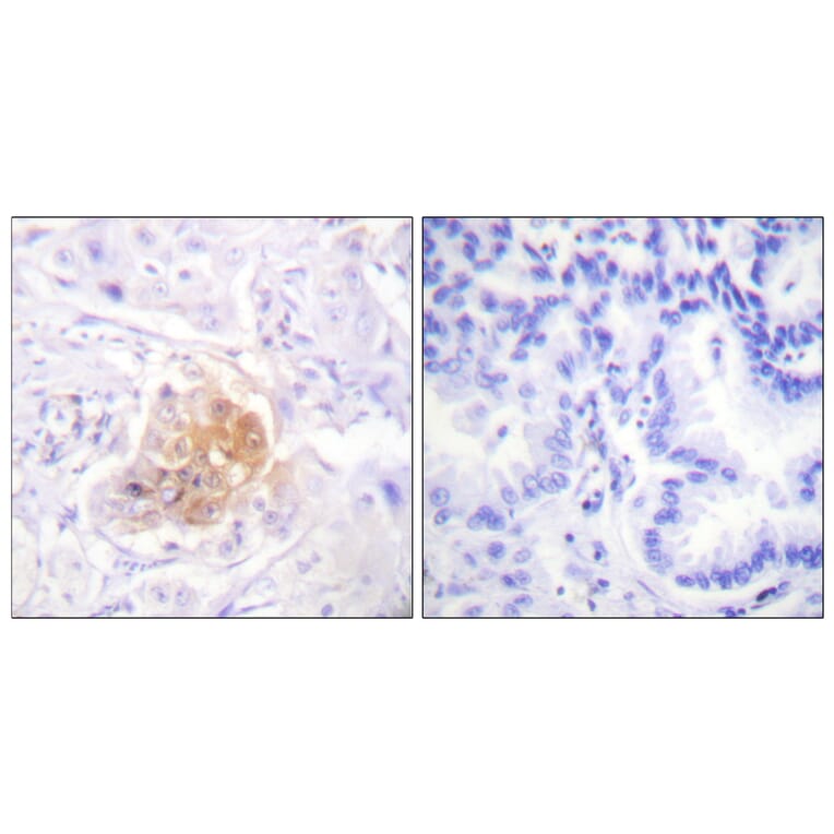 Immunohistochemistry - Anti-IL-2R beta Antibody (B1063) - Antibodies.com