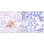 Immunohistochemistry - Anti-IL-2R beta Antibody (B1063) - Antibodies.com