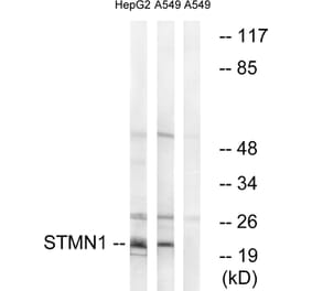 Western Blot - Anti-Stathmin 1 Antibody (B7232) - Antibodies.com