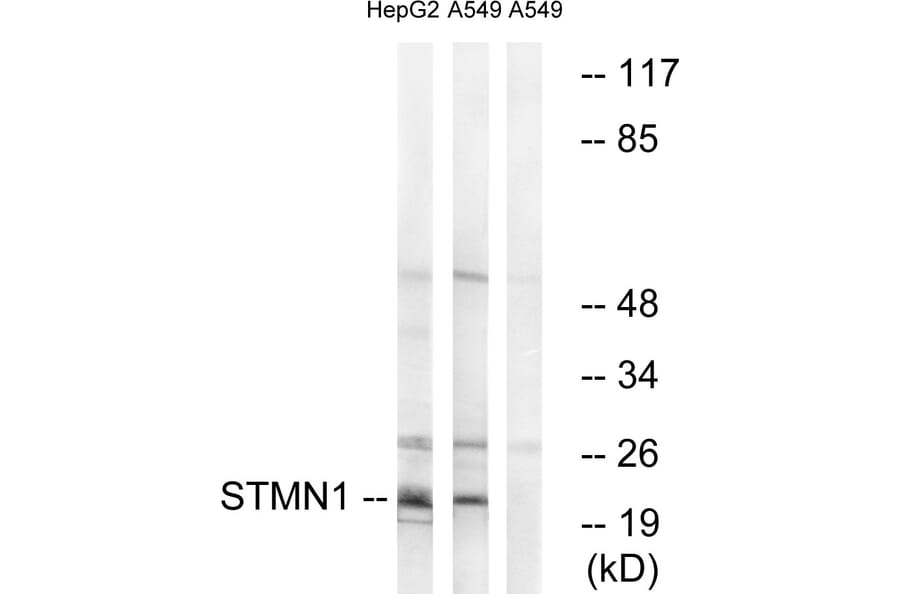 Western Blot - Anti-Stathmin 1 Antibody (B7232) - Antibodies.com