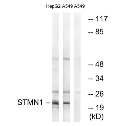 Western Blot - Anti-Stathmin 1 Antibody (B7232) - Antibodies.com