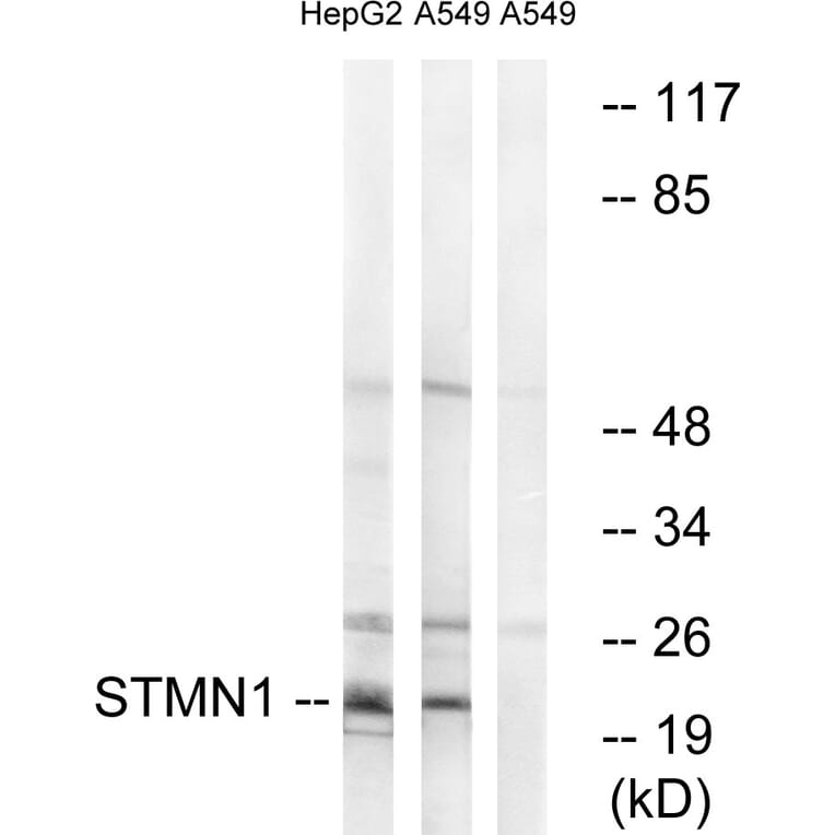 Western Blot - Anti-Stathmin 1 Antibody (B7232) - Antibodies.com