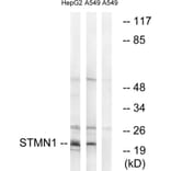 Western Blot - Anti-Stathmin 1 Antibody (B7232) - Antibodies.com