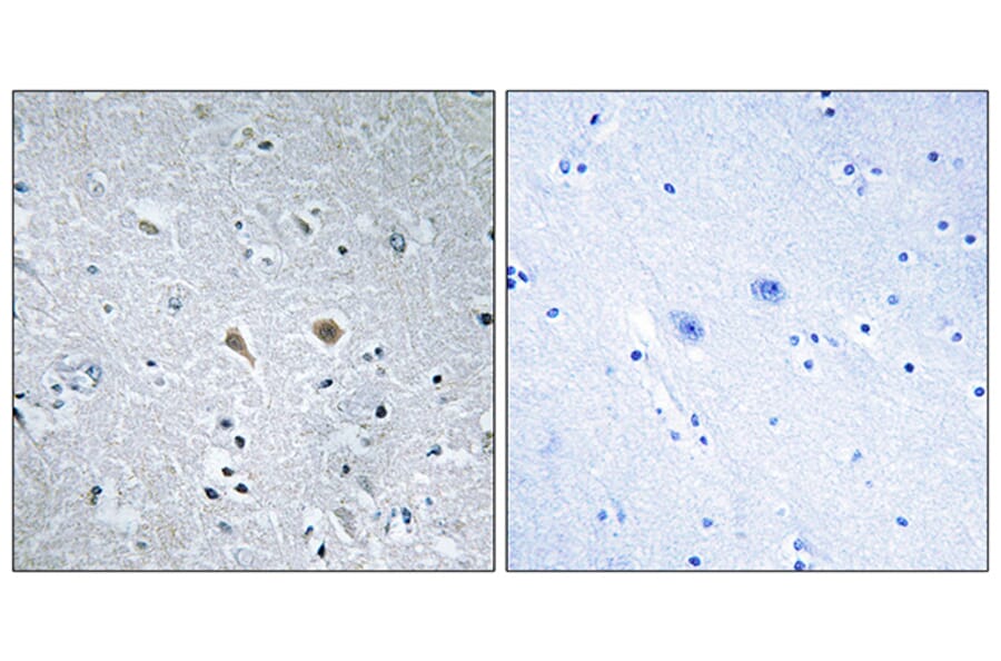 Immunohistochemistry - Anti-Stathmin 1 Antibody (B7232) - Antibodies.com