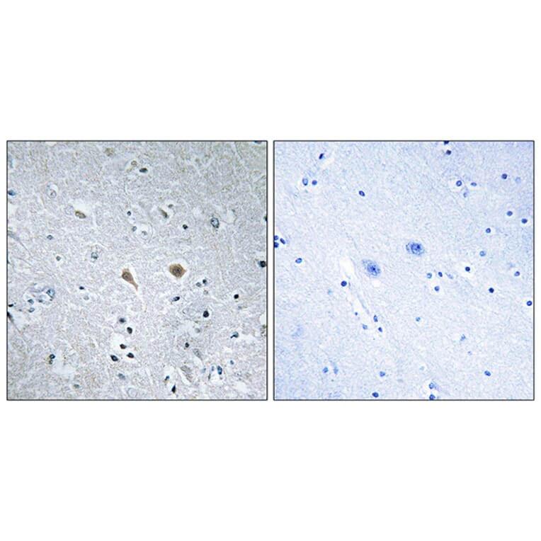 Immunohistochemistry - Anti-Stathmin 1 Antibody (B7232) - Antibodies.com