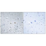 Immunohistochemistry - Anti-Stathmin 1 Antibody (B7232) - Antibodies.com