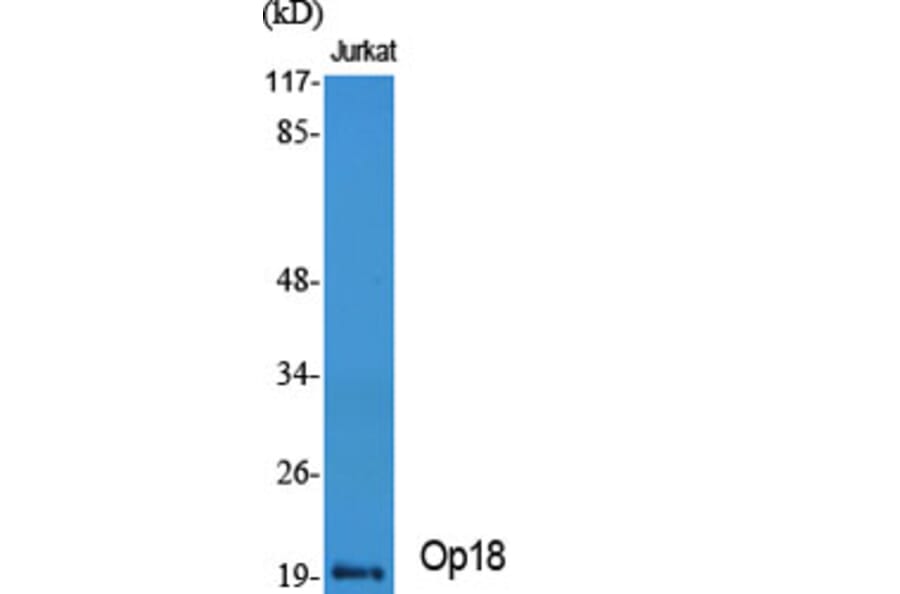 Western Blot - Anti-Stathmin 1 Antibody (B7232) - Antibodies.com