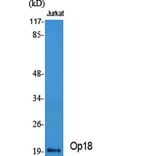 Western Blot - Anti-Stathmin 1 Antibody (B7232) - Antibodies.com