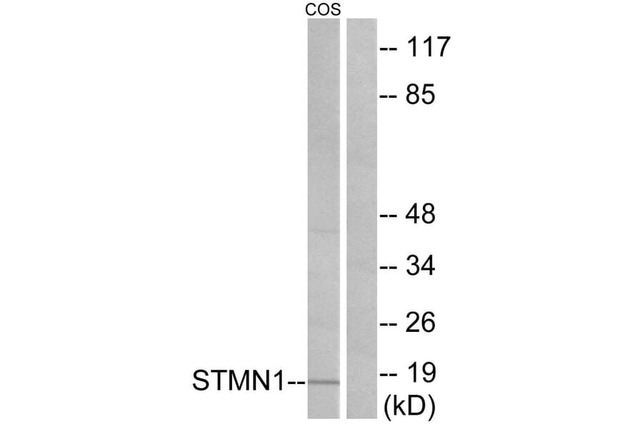 Western Blot - Anti-Stathmin 1 Antibody (B7231) - Antibodies.com