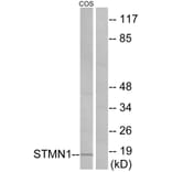 Western Blot - Anti-Stathmin 1 Antibody (B7231) - Antibodies.com