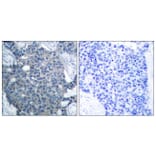 Immunohistochemistry - Anti-Stathmin 1 Antibody (B7231) - Antibodies.com