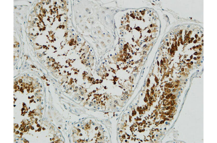 Immunohistochemistry - Anti-Stathmin 1 Antibody (B7231) - Antibodies.com