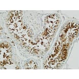 Immunohistochemistry - Anti-Stathmin 1 Antibody (B7231) - Antibodies.com