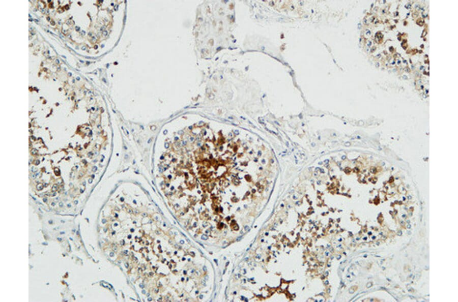 Immunohistochemistry - Anti-Stathmin 1 Antibody (B7231) - Antibodies.com