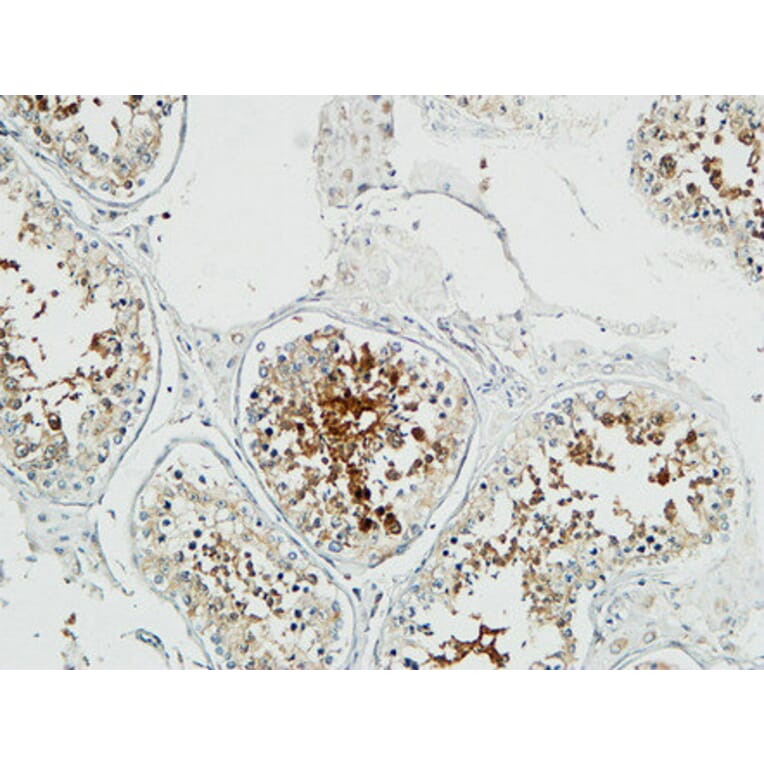 Immunohistochemistry - Anti-Stathmin 1 Antibody (B7231) - Antibodies.com