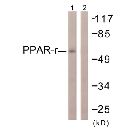 Western Blot - Anti-PPAR-gamma Antibody (B0557) - Antibodies.com