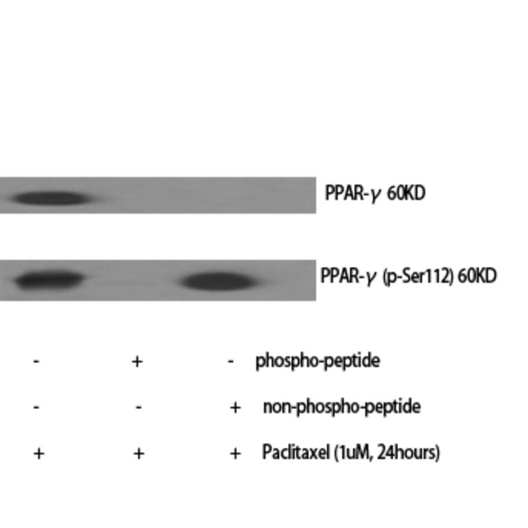 Western Blot - Anti-PPAR-gamma Antibody (B0557) - Antibodies.com