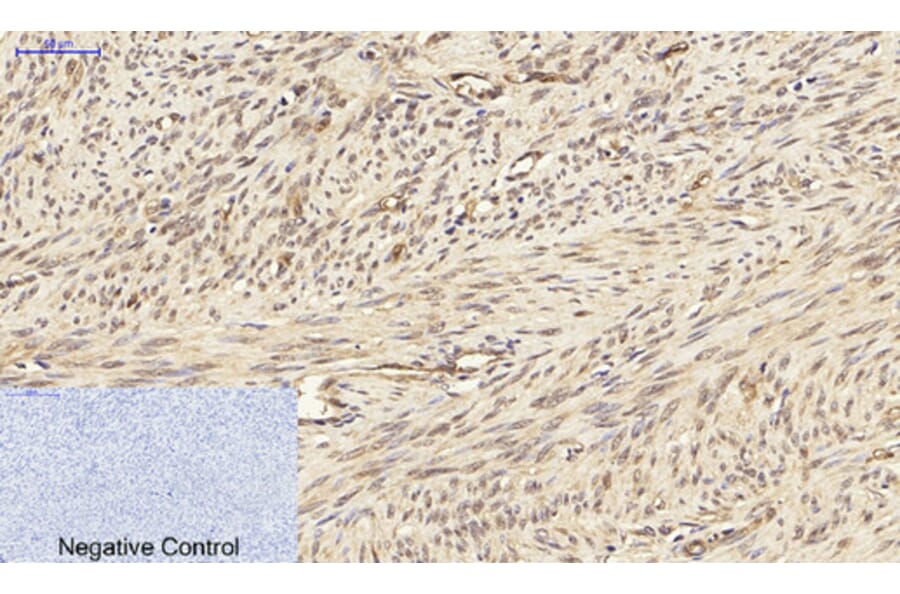 Immunohistochemistry - Anti-PPAR-gamma Antibody (B0557) - Antibodies.com