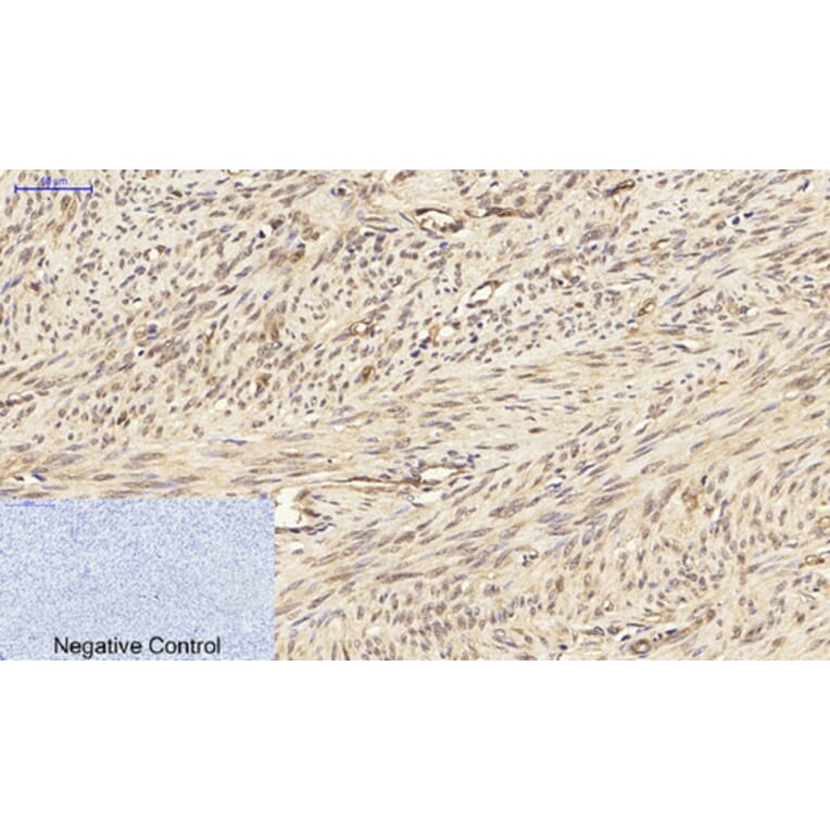 Immunohistochemistry - Anti-PPAR-gamma Antibody (B0557) - Antibodies.com