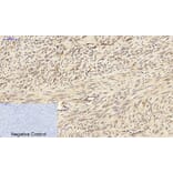 Immunohistochemistry - Anti-PPAR-gamma Antibody (B0557) - Antibodies.com