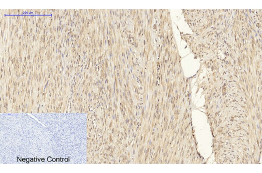 Immunohistochemistry - Anti-PPAR-gamma Antibody (B0557) - Antibodies.com