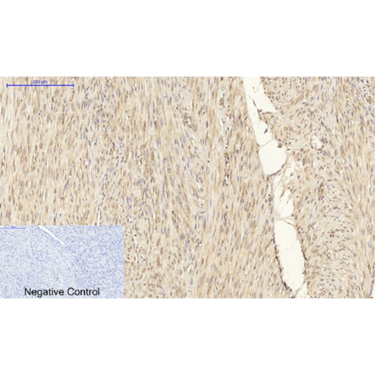 Immunohistochemistry - Anti-PPAR-gamma Antibody (B0557) - Antibodies.com