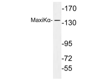 Western Blot - Anti-MaxiKalpha Antibody (R12-2233) - Antibodies.com