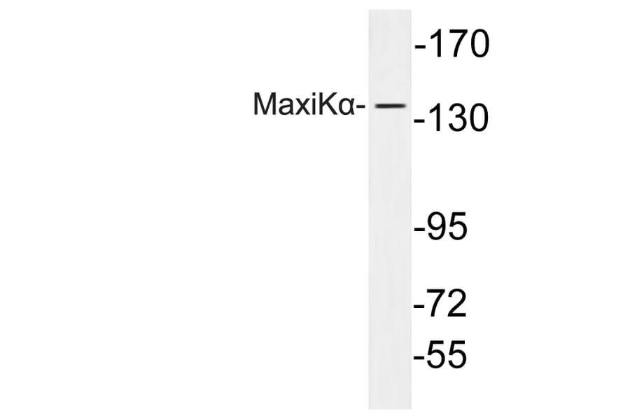 Western Blot - Anti-MaxiKalpha Antibody (R12-2233) - Antibodies.com