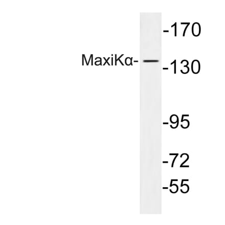 Western Blot - Anti-MaxiKalpha Antibody (R12-2233) - Antibodies.com