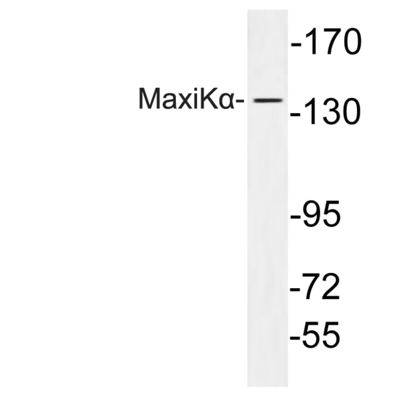 Western Blot - Anti-MaxiKalpha Antibody (R12-2233) - Antibodies.com