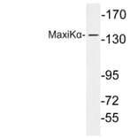 Western Blot - Anti-MaxiKalpha Antibody (R12-2233) - Antibodies.com
