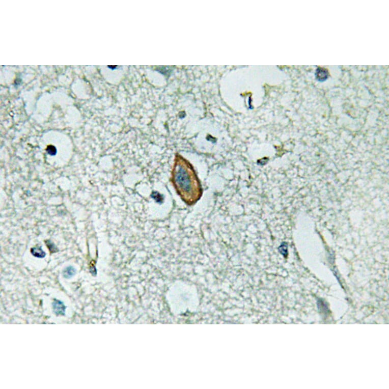 Immunohistochemistry - Anti-MaxiKalpha Antibody (R12-2233) - Antibodies.com