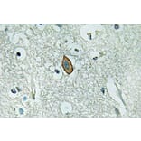Immunohistochemistry - Anti-MaxiKalpha Antibody (R12-2233) - Antibodies.com