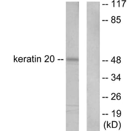 Western Blot - Anti-Keratin 20 Antibody (C0245) - Antibodies.com