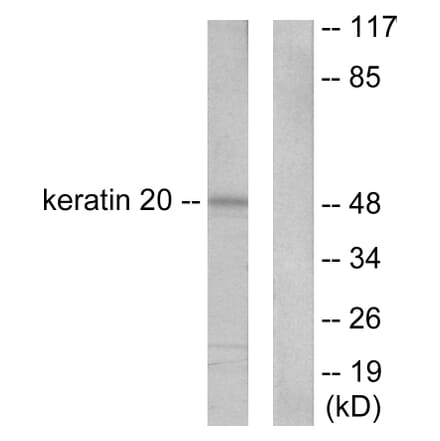 Western Blot - Anti-Keratin 20 Antibody (C0245) - Antibodies.com