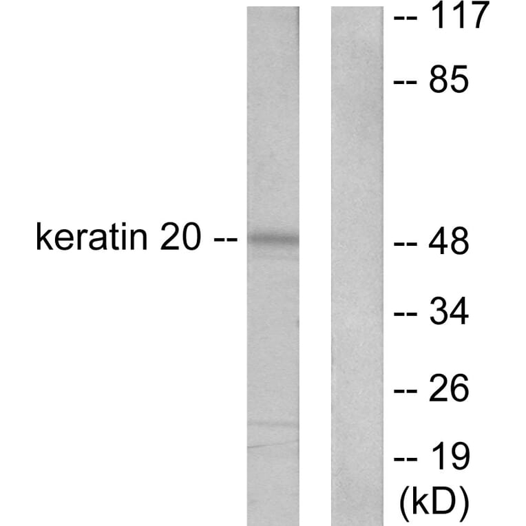 Western Blot - Anti-Keratin 20 Antibody (C0245) - Antibodies.com