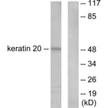 Western Blot - Anti-Keratin 20 Antibody (C0245) - Antibodies.com