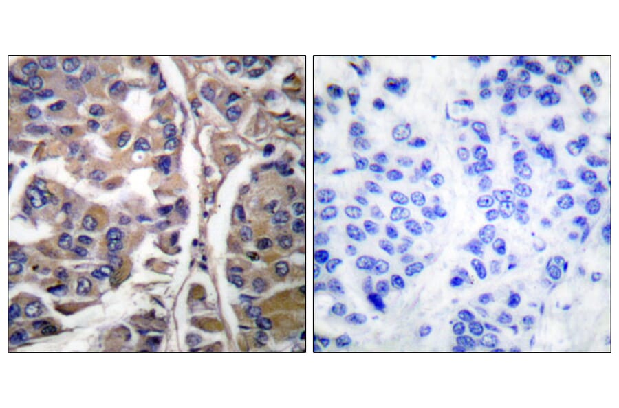 Immunohistochemistry - Anti-Keratin 20 Antibody (C0245) - Antibodies.com