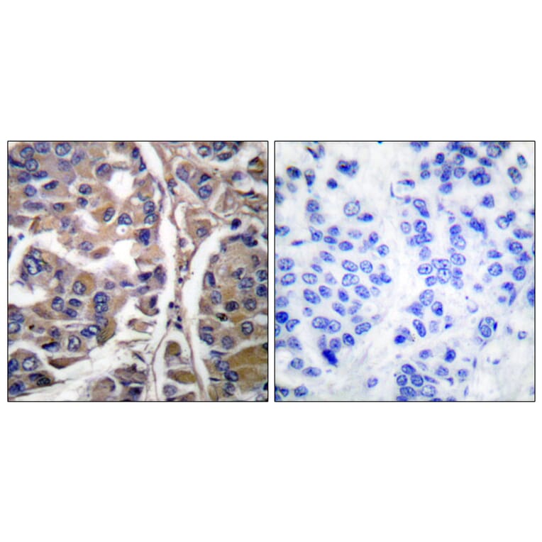 Immunohistochemistry - Anti-Keratin 20 Antibody (C0245) - Antibodies.com