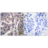 Immunohistochemistry - Anti-Keratin 20 Antibody (C0245) - Antibodies.com
