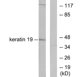 Western Blot - Anti-Keratin 19 Antibody (C0244) - Antibodies.com