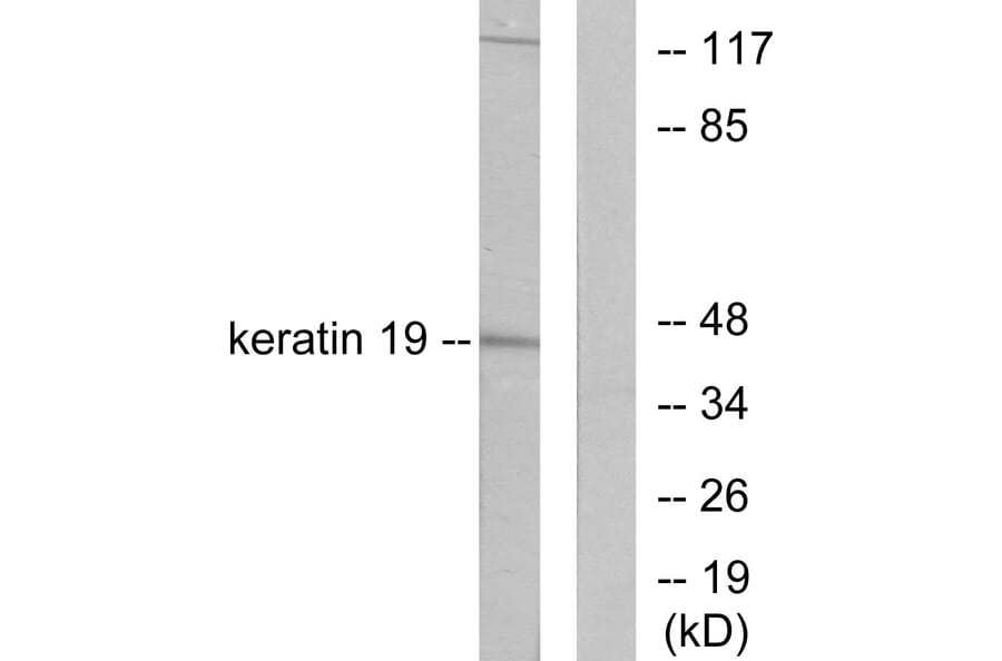 Western Blot - Anti-Keratin 19 Antibody (C0244) - Antibodies.com